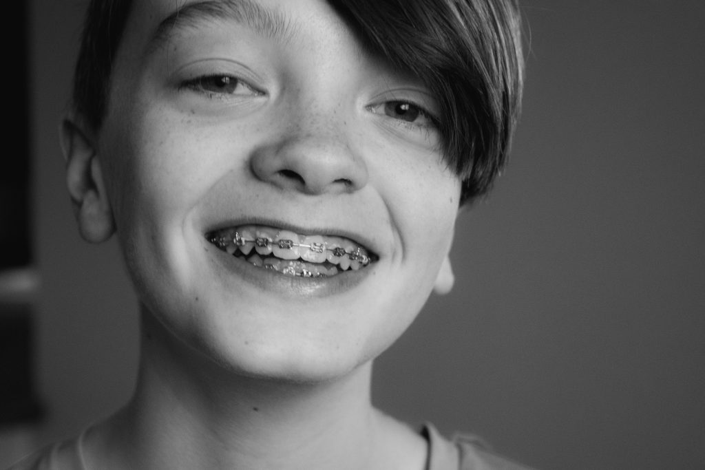 Does Flossing Create Gaps in Children’s Teeth? 10 Useful Flossing Tips for Young Children